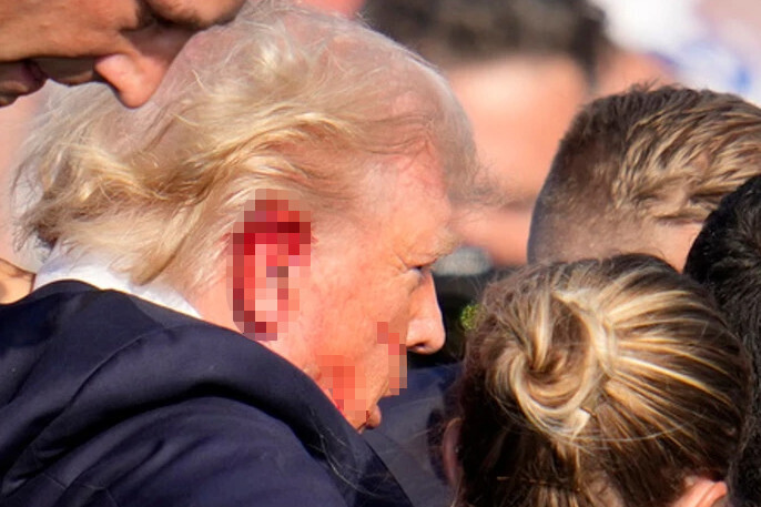 Ông Donald Trump bị thương ở vùng tai phải.