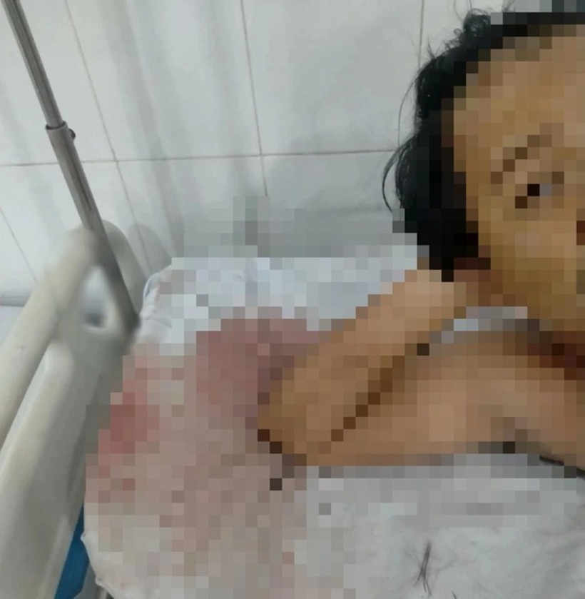 Anh N.L nằm viện điều trị sau khi bị nhóm 5 người xông vào phòng trọ hành hung. Ảnh: Báo Thanh Niên