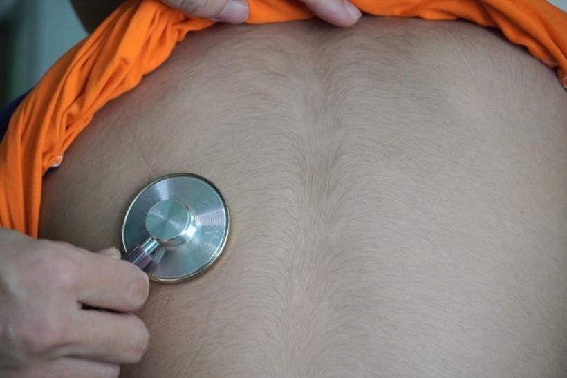 Lưng bệnh nhi mọc lông rậm rạp