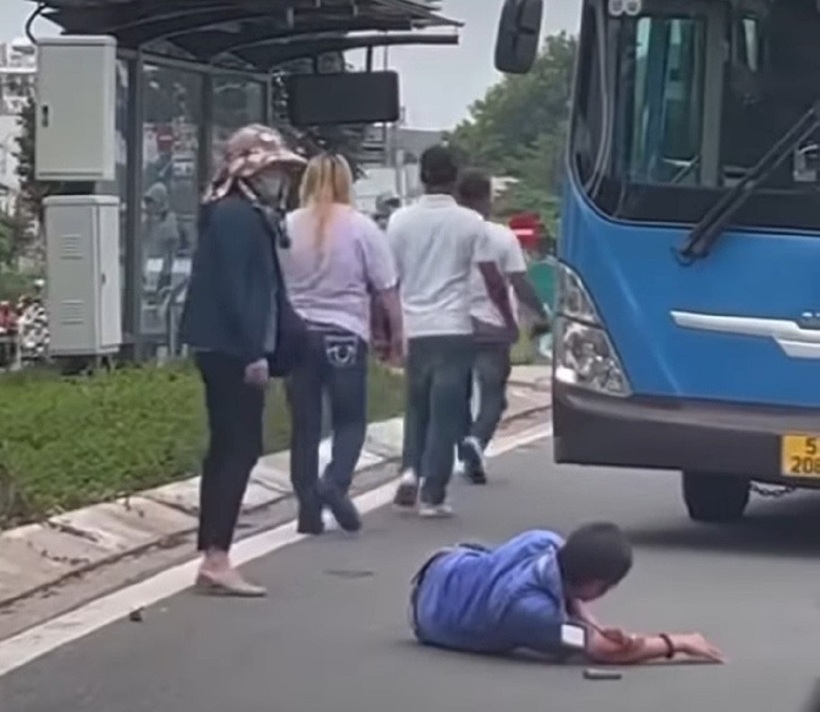 Tài xế xe buýt bị đánh gãy răng. Ảnh: Tuổi Trẻ
