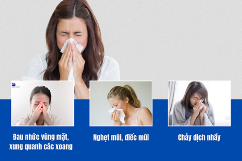 3 triệu chứng điển hình nhất của bệnh viêm xoang