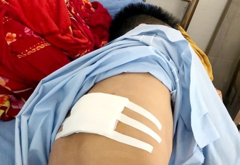 Anh L.V.N bị đối tượng chém trọng thương phải nhập viện. Ảnh: Lao Động