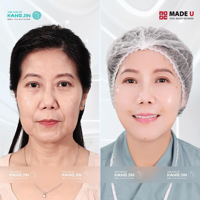 6 điểm khác biệt khi làm đẹp trẻ hóa tại Viện Thẩm Mỹ Kangjin - 3