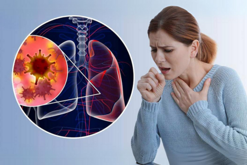 Gần 24.000 ca tử vong mỗi năm do ung thư phổi tại Việt Nam