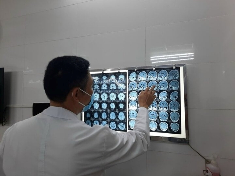 Hình ảnh phim chụp sán làm tổn thương não bệnh nhân. Ảnh: VTC News