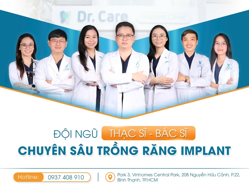 4 loại trụ Implant nên ưu tiên khi trồng răng Implant - 4