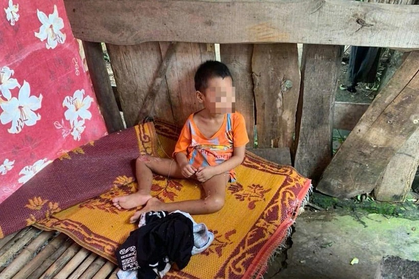 Bé trai một mình trong căn lán tạm với nhiều vết thương. Ảnh: Dân Trí