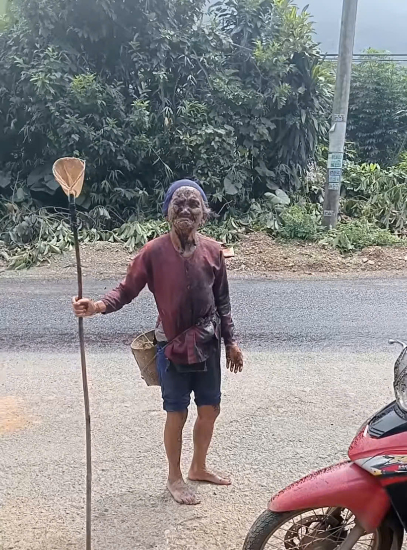Cụ bà bị đơn vị thi công phun nhựa đường vào mặt.