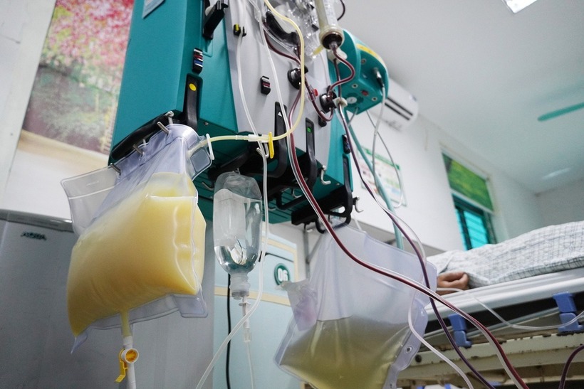 Huyết tương của bệnh nhân được đưa ra ngoài có màu trắng đục như sữa. Ảnh: Tuổi Trẻ Online