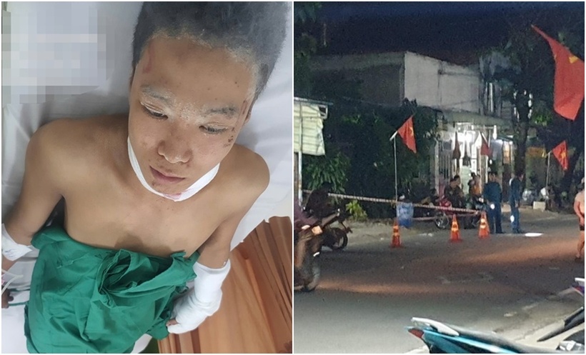 Đối tượng Đặng Minh Hiếu được Công an đưa đến Bệnh viện đa khoa tỉnh Bình Dương cấp cứu. (Ảnh: BVPL)