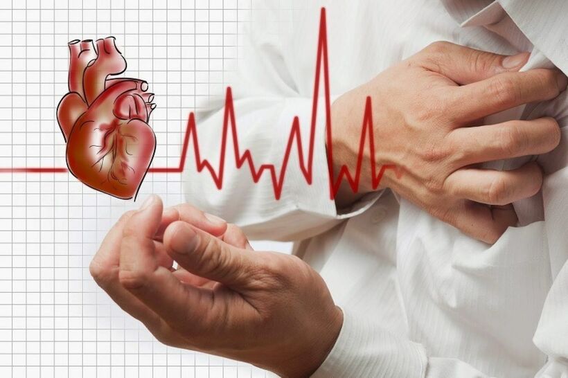 Huyết áp cao thường tiến triển âm thầm trong thời gian dài mà không biểu hiện triệu chứng rõ ràng dễ dẫn đến biến chứng nặng hơn. Ảnh minh họa