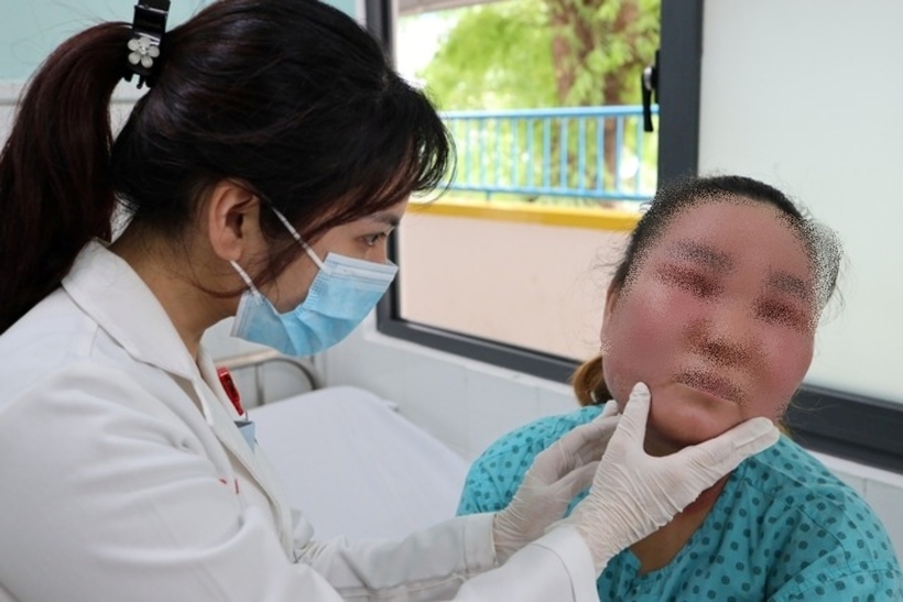 Bệnh nhân nhập viện trong tình trạng sưng nề cả vùng mặt và mắt, rỉ dịch vàng, ngứa và đau rát. Ảnh: Sức Khỏe & Đời Sống