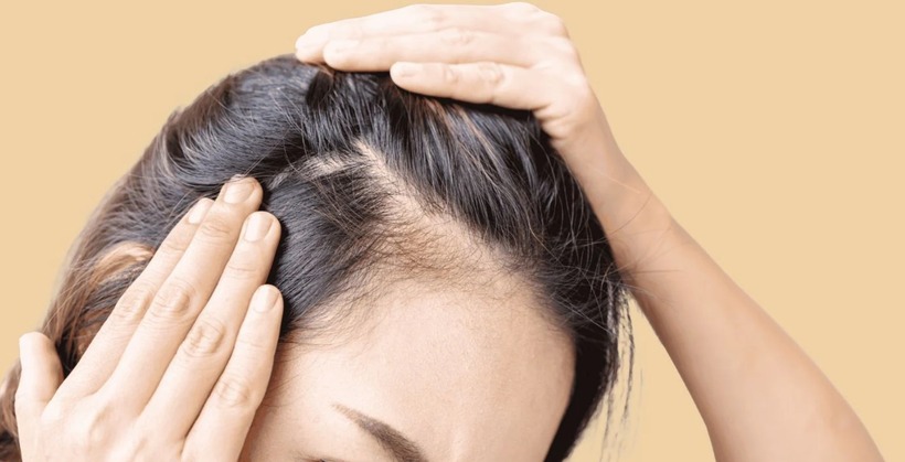 Nếu bạn đang gặp tình trạng rụng tóc nghiêm trọng, hãy đến gặp bác sĩ để được tư vấn và điều trị.