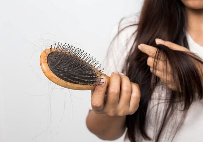 Tóc rụng là nỗi ám ảnh của nhiều người, ảnh hưởng không nhỏ đến sự tự tin và chất lượng cuộc sống.