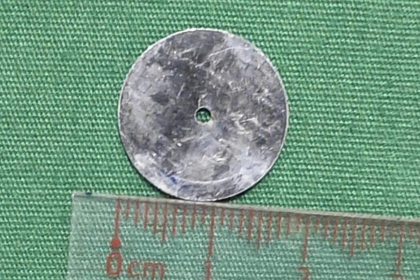 Mảnh kim loại tròn, đường kính lớn được lấy ra khỏi đường thở của bệnh nhi. Ảnh: Dân Trí