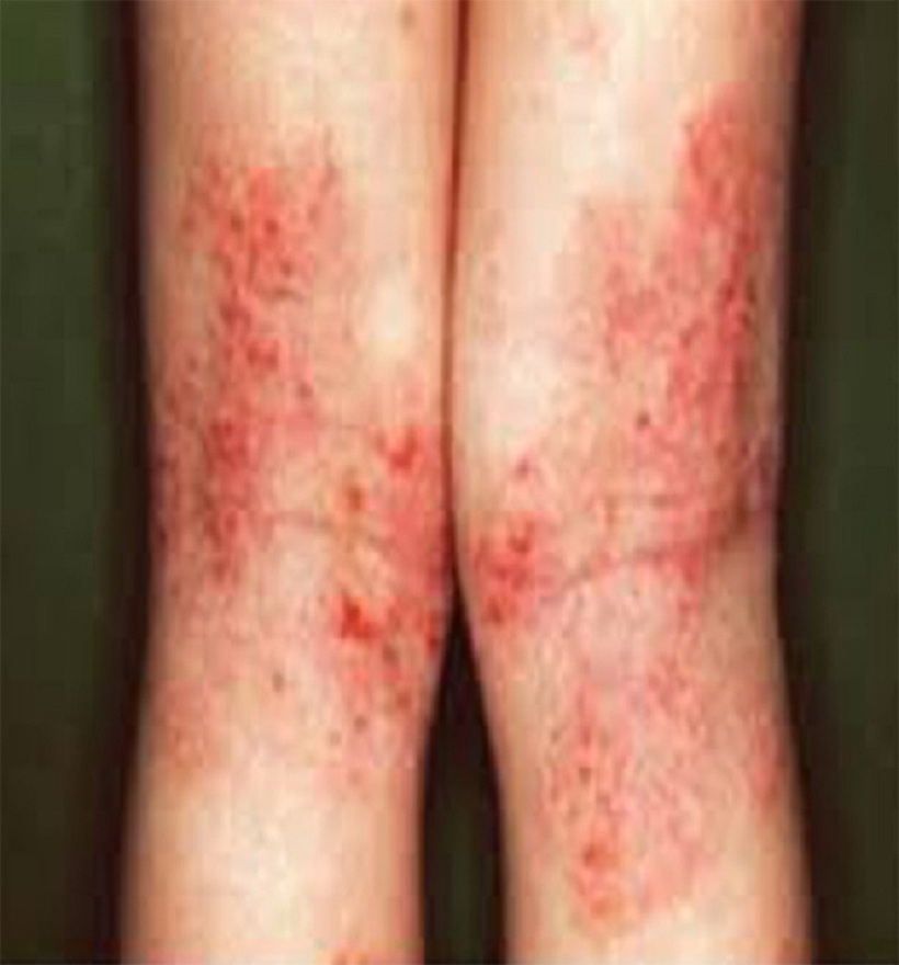 Khám bệnh và tư vấn miễn phí tại hệ thống phòng khám Bảo Thanh Đường