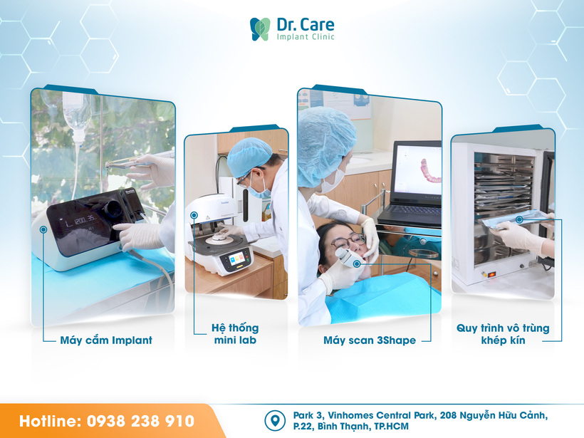 Dr. Care: Nha khoa tiên phong ứng dụng công nghệ cao trong trồng răng Implant - 2