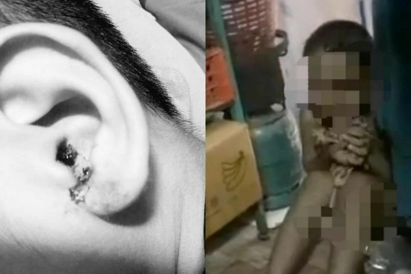 Kể từ sự cố, con trai bà sợ hãi không dám đến trường và vẫn cảm thấy đau ở tai. Ảnh: The Thaiger.