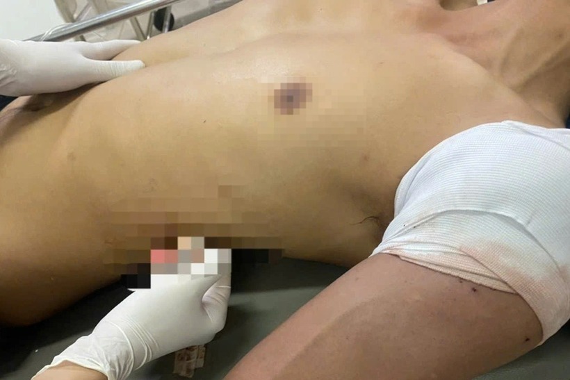 Nam thanh niên bị thương phải nhập viện cấp cứu. Ảnh: Dân trí