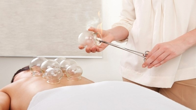 Giác hơi là liệu pháp y học cổ truyền được ưa chuộng nhưng không phải ai cũng phù hợp