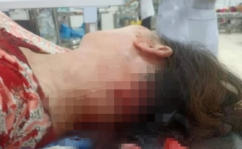 Người phụ nữ bán thịt lợn bị tấn công. Ảnh: Lao động