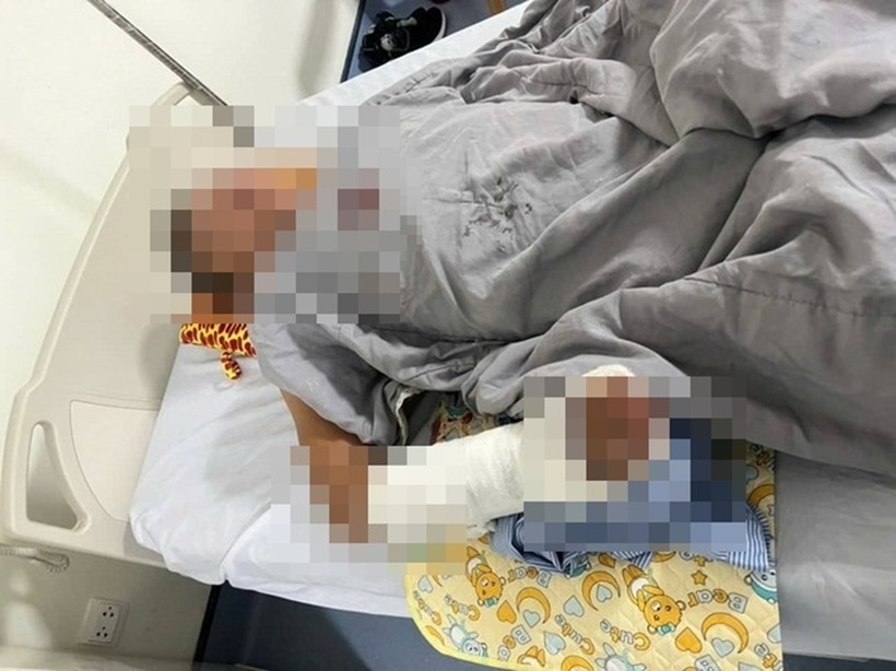 Nạn nhân bị thương trong vụ chém người chỉ vì câu nói "không phải việc của mày" đang được điều trị tại bệnh viện. Ảnh: Báo Giao thông