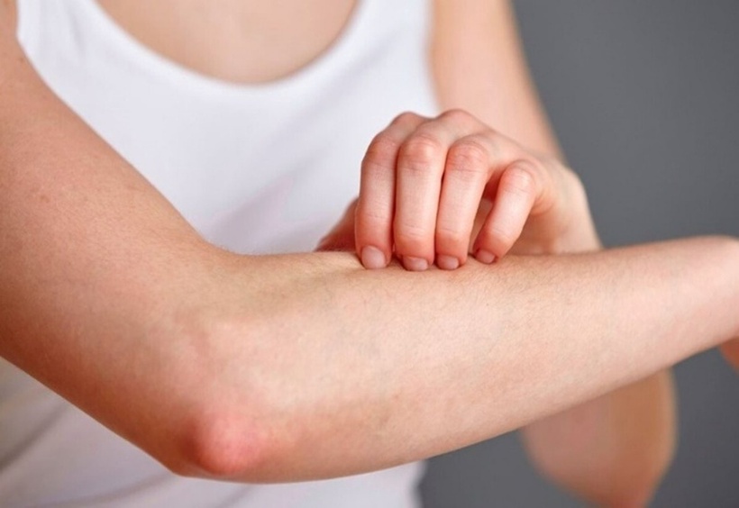 Mẩn đỏ thông thường có thể xuất phát từ nhiều yếu tố.
