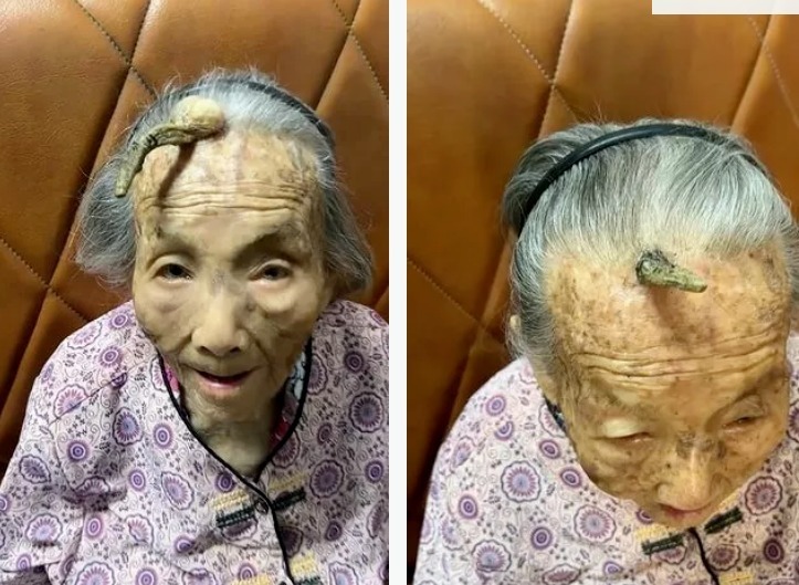 Cận cảnh "chiếc sừng trường thọ" của cụ bà. Ảnh: NX/ VTC News