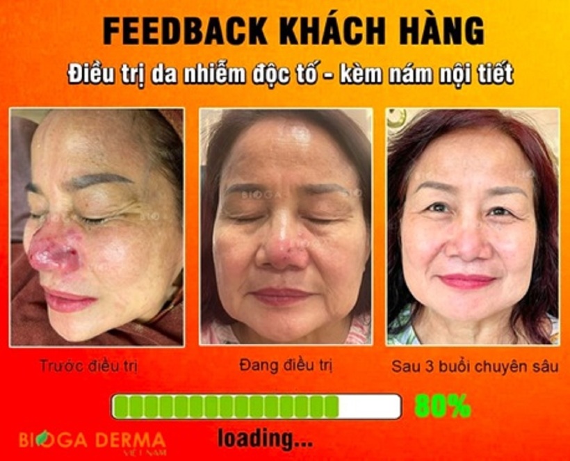 Bộ Mỹ Phẩm BIOGA Derma: Thương hiệu mỹ phẩm sinh học trị nám, sẹo, kích ứng da hiệu quả - 7
