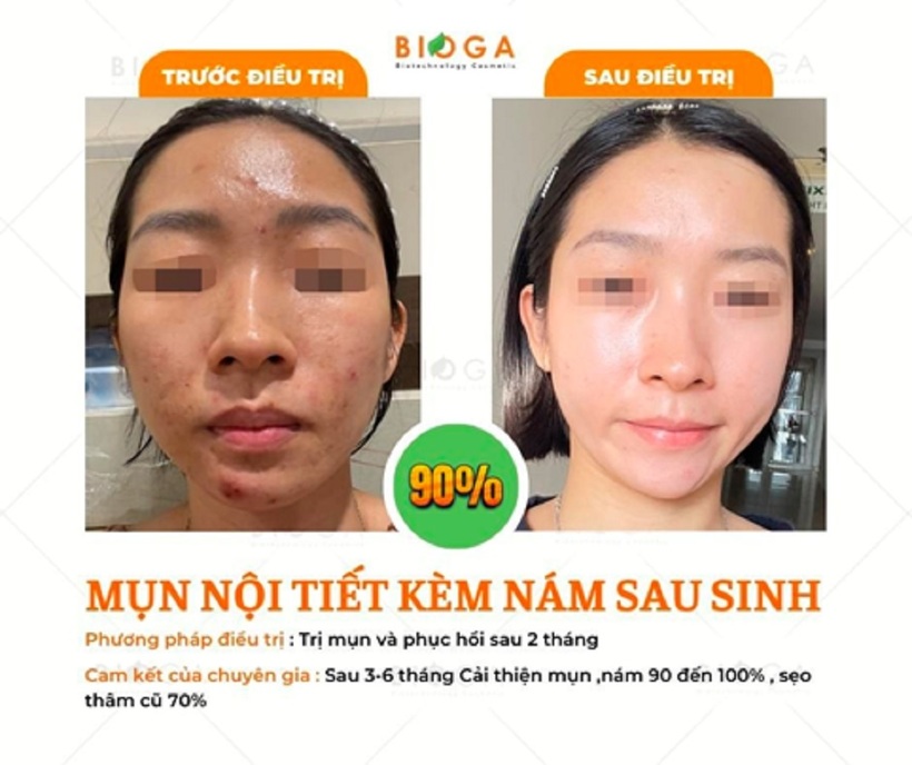 Bộ Mỹ Phẩm BIOGA Derma: Thương hiệu mỹ phẩm sinh học trị nám, sẹo, kích ứng da hiệu quả - 8