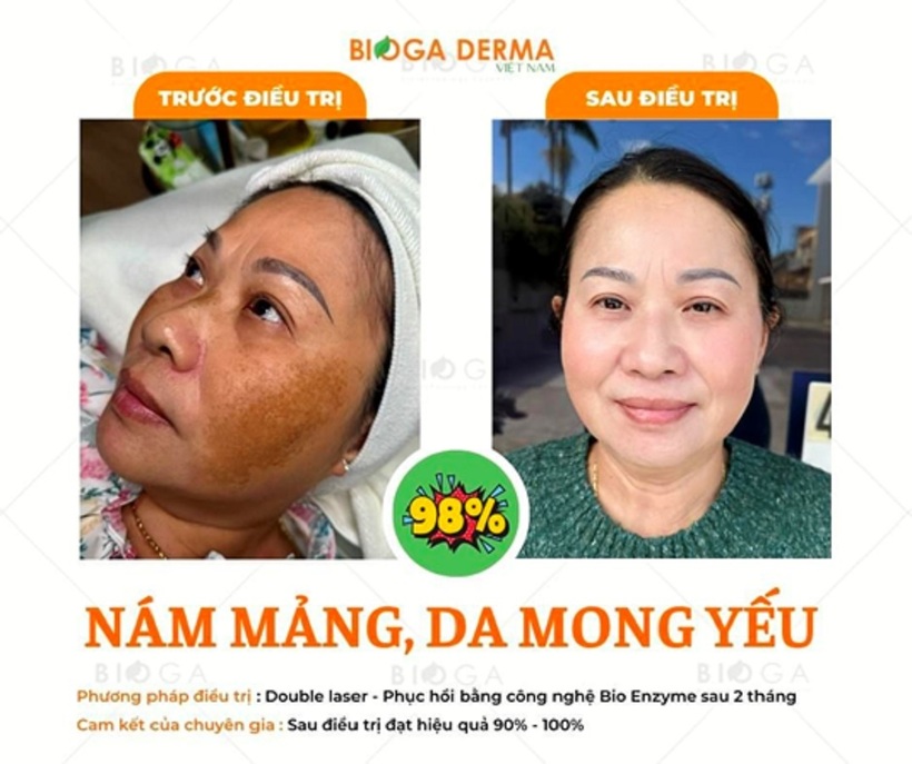 Bộ Mỹ Phẩm BIOGA Derma: Thương hiệu mỹ phẩm sinh học trị nám, sẹo, kích ứng da hiệu quả - 9