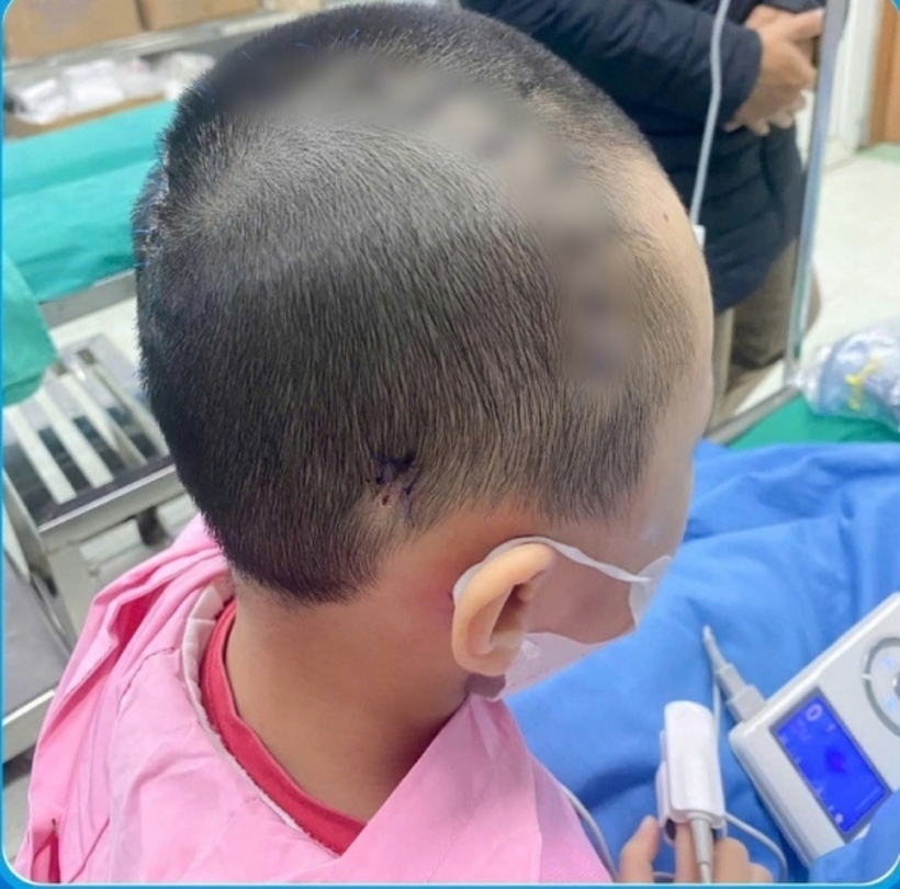 Bé 7 tuổi đang hồi phục tốt, trở lại cuộc sống bình thường với diện mạo lành lặn. Ảnh: Gia Đình Việt Nam