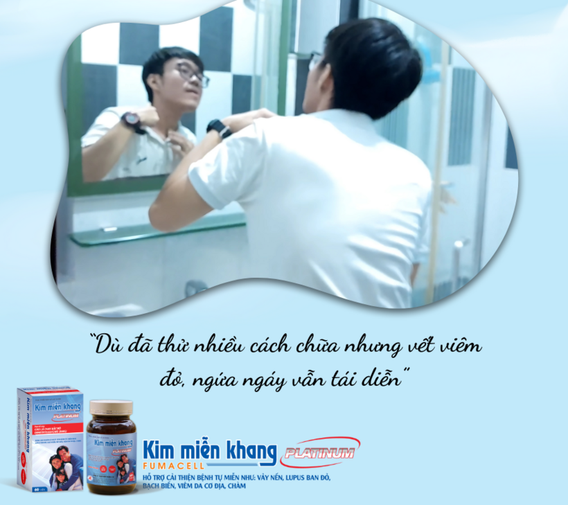 Anh Thịnh đã thử nhiều cách nhưng bệnh viêm da cơ địa chỉ tạm đỡ rồi lại tái phát