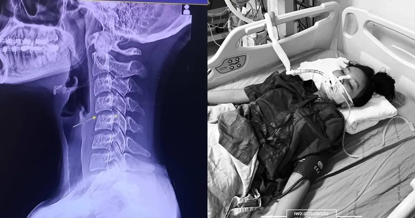 Sự việc đáng tiếc xảy ra khiến nữ ca sĩ Ping Chayada đã qua đời ở tuổi 20