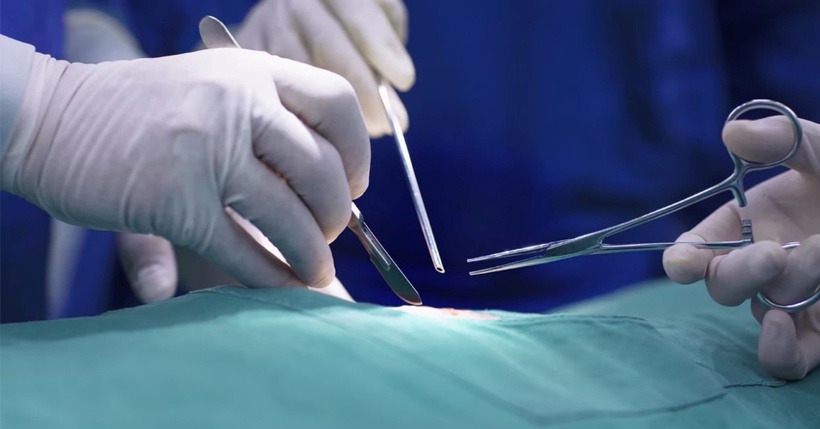 Nam bác sĩ bị cáo buộc cắt nhầm gan của bệnh nhân thay vì lá lách khiến người này tử vong ngay lập tức. Ảnh minh họa