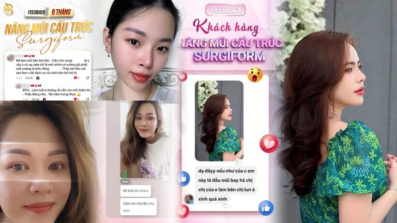 Bê Trần - Phòng khám phẫu thuật thẩm mỹ luôn đi đầu với sứ mệnh làm đẹp cho đời - 24
