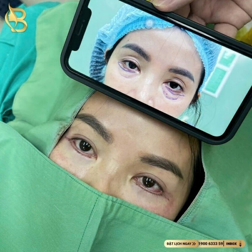 Bê Trần - Phòng khám phẫu thuật thẩm mỹ luôn đi đầu với sứ mệnh làm đẹp cho đời - 16