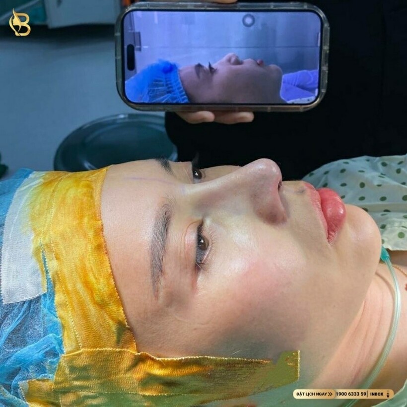 Bê Trần - Phòng khám phẫu thuật thẩm mỹ luôn đi đầu với sứ mệnh làm đẹp cho đời - 17