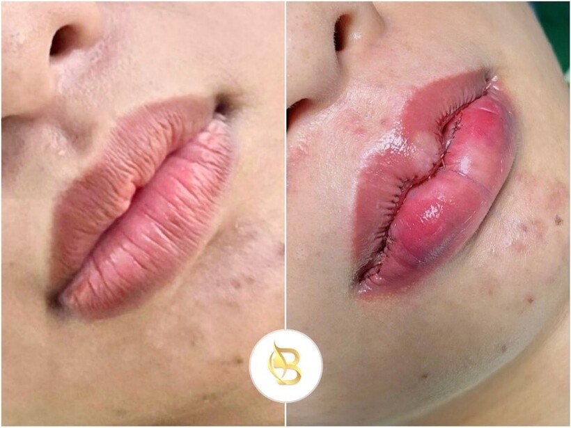 Bê Trần - Phòng khám phẫu thuật thẩm mỹ luôn đi đầu với sứ mệnh làm đẹp cho đời - 19