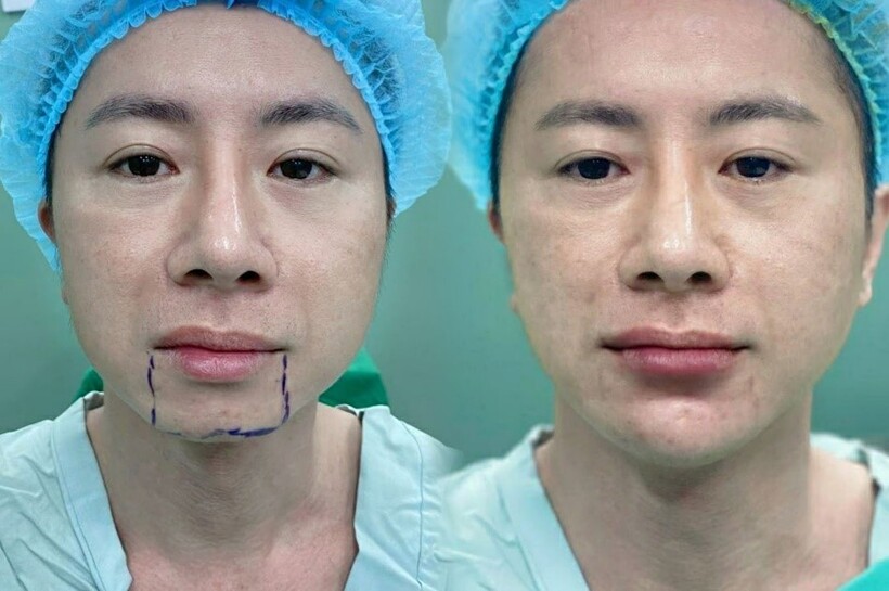 Bê Trần - Phòng khám phẫu thuật thẩm mỹ luôn đi đầu với sứ mệnh làm đẹp cho đời - 20