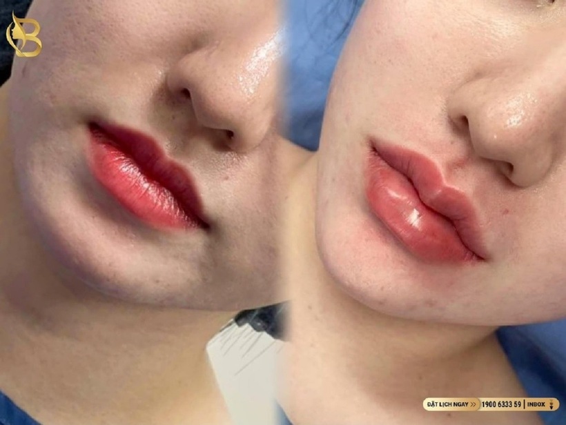 Bê Trần - Phòng khám phẫu thuật thẩm mỹ luôn đi đầu với sứ mệnh làm đẹp cho đời - 21