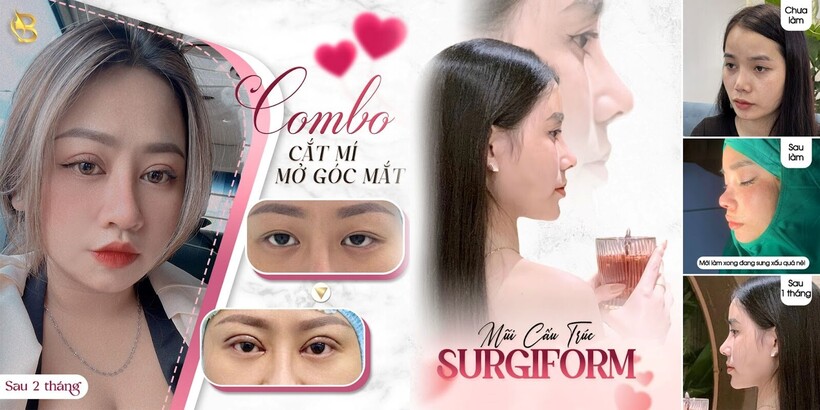 Bê Trần - Phòng khám phẫu thuật thẩm mỹ luôn đi đầu với sứ mệnh làm đẹp cho đời - 22