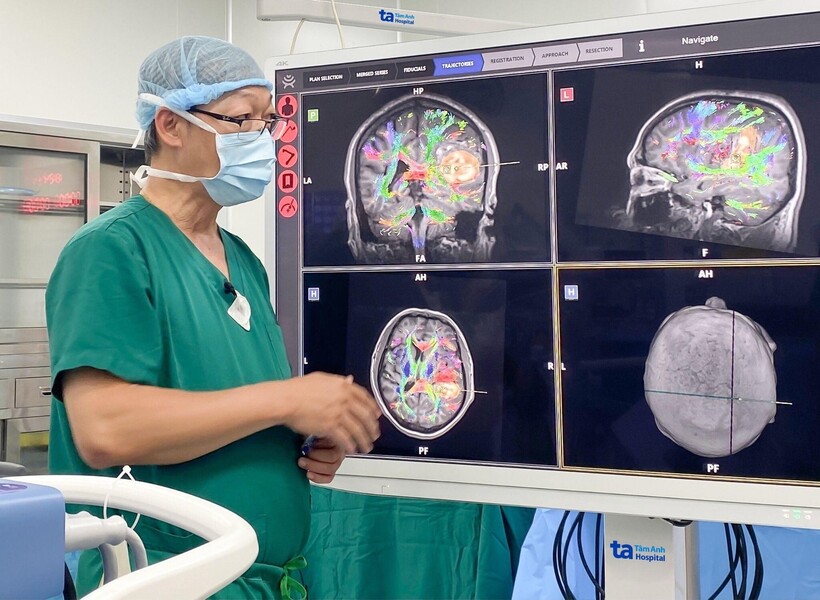 Robot AI trộn hình MRI, DTI… cho thấy rõ các bó sợi thần kinh và khối máu tụ chèn ép trong não người bệnh. Ảnh: Bệnh viện Đa khoa Tâm Anh TP.HCM