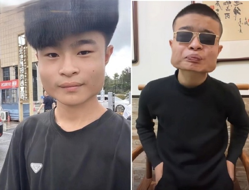 Mặt cậu bị biến dạng sau khi ăn và thậm chí còn được các bạn cùng lớp đặt cho biệt danh là "TV". Ảnh: SkyPost.