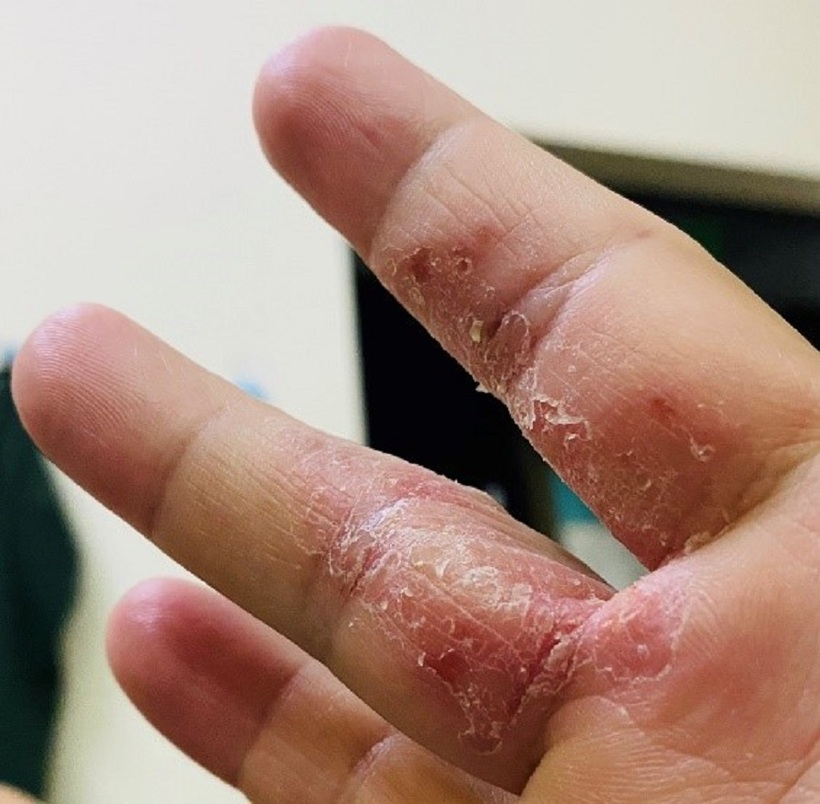 Phương thuốc nổi tiếng trị bệnh ngoài da – Bảo Thanh Đường - 1