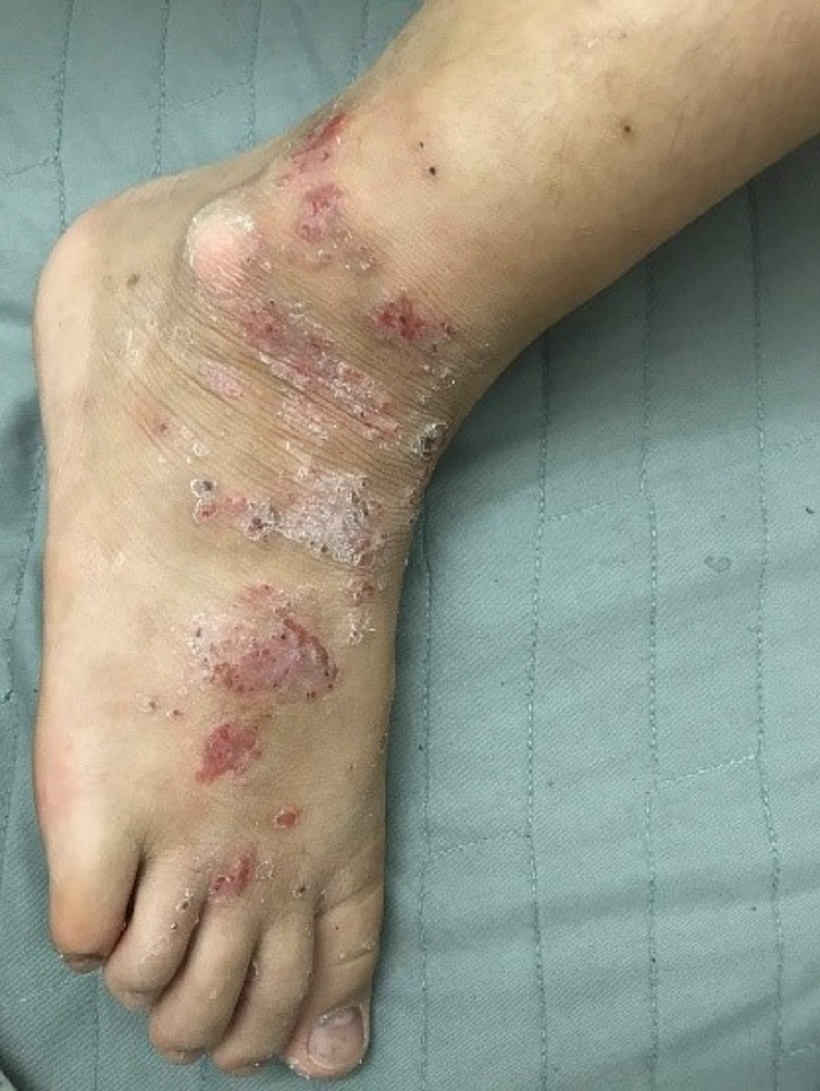 Phương thuốc nổi tiếng trị bệnh ngoài da – Bảo Thanh Đường - 2