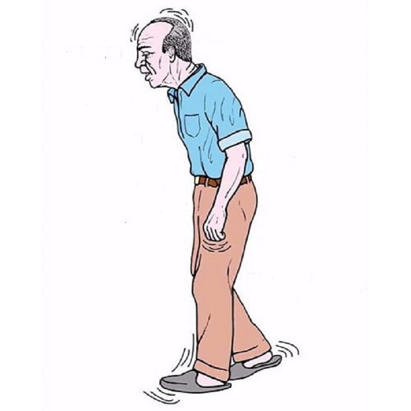 Run chân tay ở người cao tuổi có thể là dấu hiệu của bệnh lý Parkinson