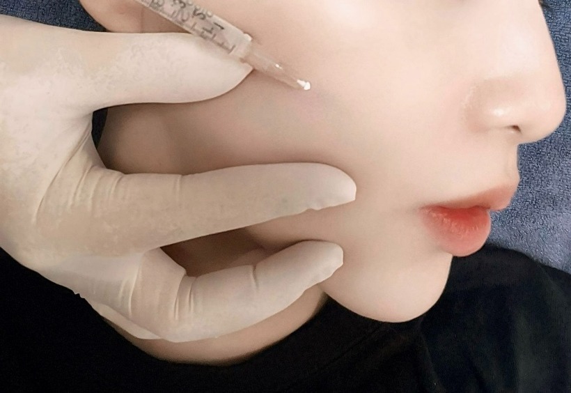 Phải nghe những lời nhận xét bóng gió về tướng mạo, rằng "phụ nữ gò má cao, không dùng dao cũng sát chồng", người phụ nữ quyết định chi tiền "khủng" tiêm gò má "vượng phu". Ảnh: VnExpress