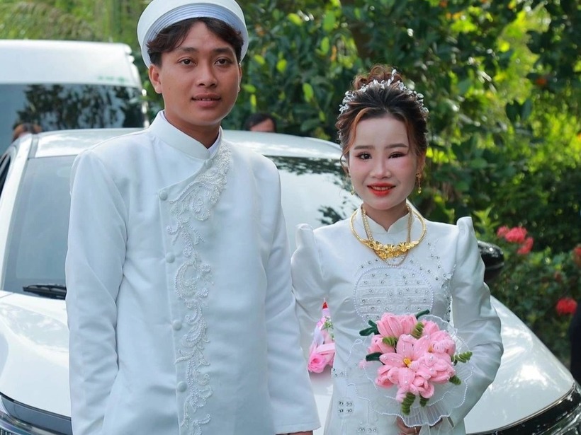 Gương mặt của cô dâu bị sưng tấy vì... ong đốt. Ảnh: Báo Dân trí.