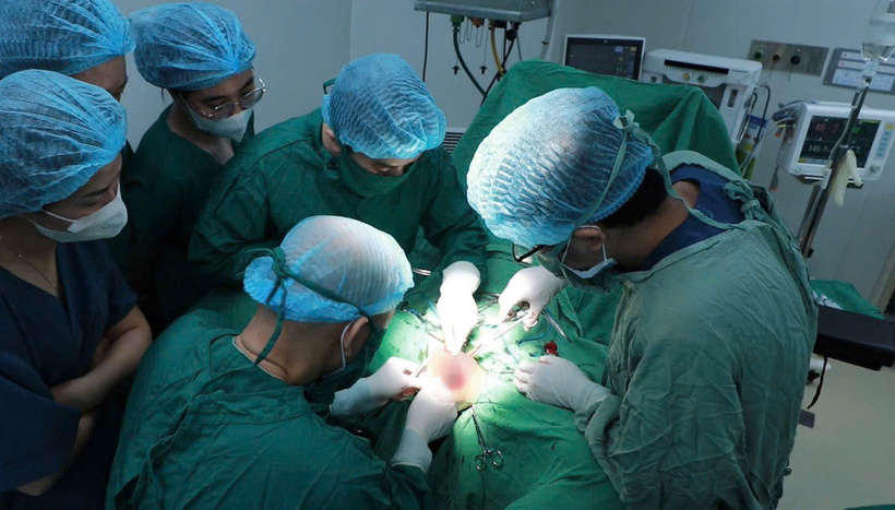 Các bác sĩ tiến hành phẫu thuật bóc tách giúp bệnh nhân. Ảnh: BVCC